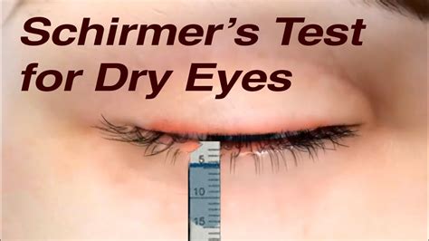 youtube tearing test|schirmer test normal value.